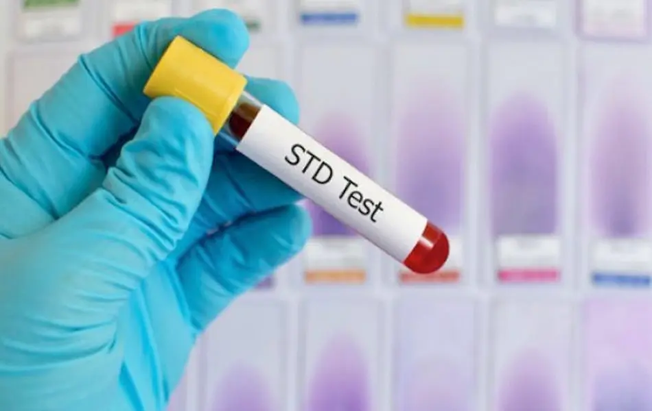 STD Screening